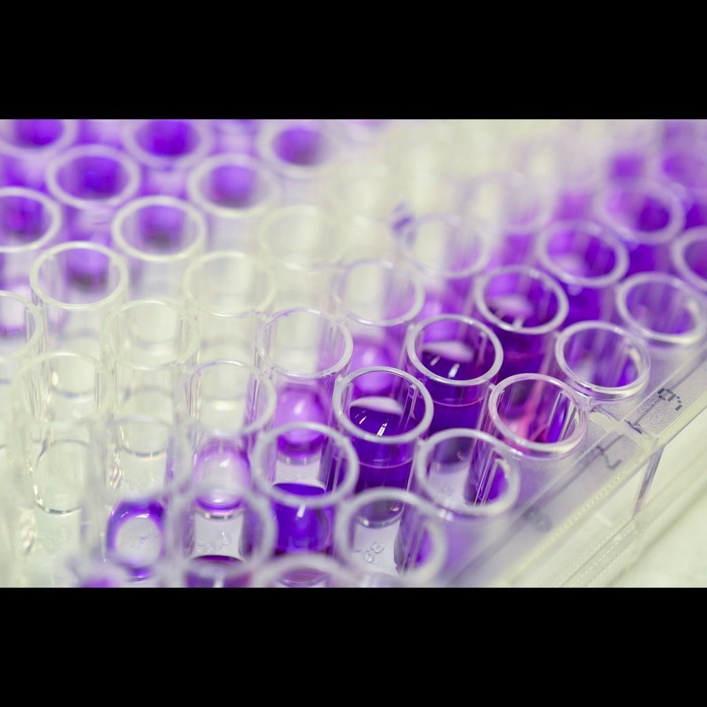 ACP6 elisa kit :: Human Lysophosphatidic acid phosphatase type 6  ACP6  ELISA Kitsize:96size:Stripsize:Wells